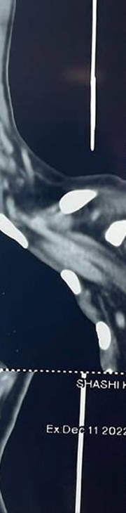 Photos of Minimal Access ENT Surgery Minimal access ENT surgery